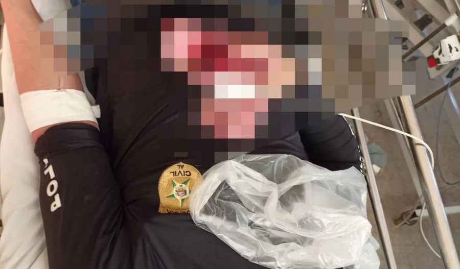 Filho suspeito de encomendar morte do pai reage à prisão e atira em policial