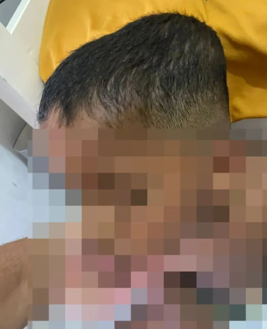 Ministério Público denuncia babá por tortura-castigo contra criança autista em Arapiraca