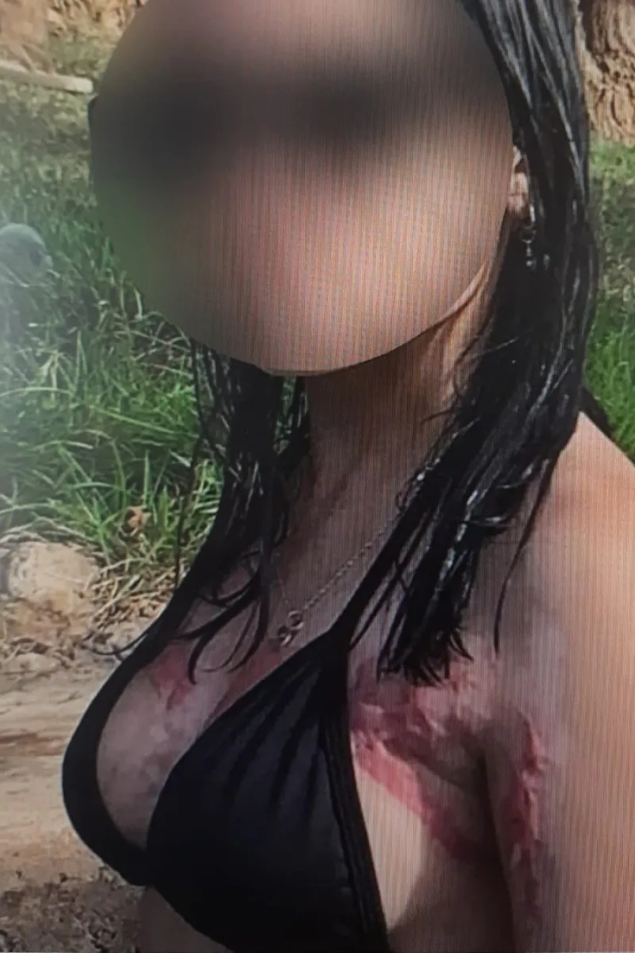 Polícia investiga caso de adolescente esganada e queimada pelo ex-namorado em Maravilha