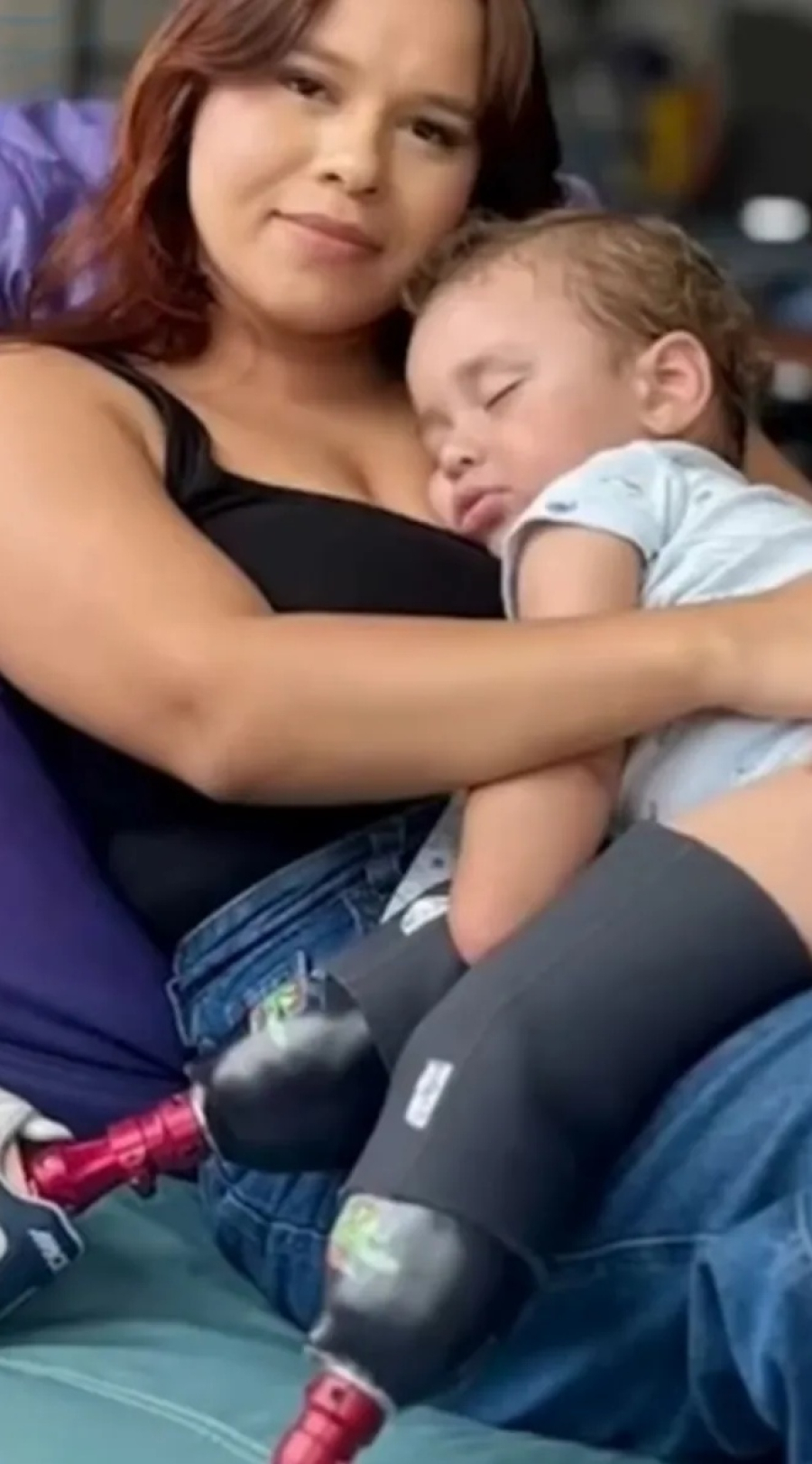 Pequeno Noah Gabriel recebe próteses em SP e inicia nova fase após luta pela vida