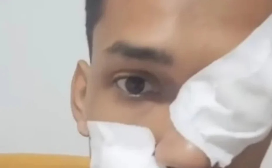 Homem é baleado na boca durante tentativa de assalto ao voltar da igreja em Palmeira dos Índios