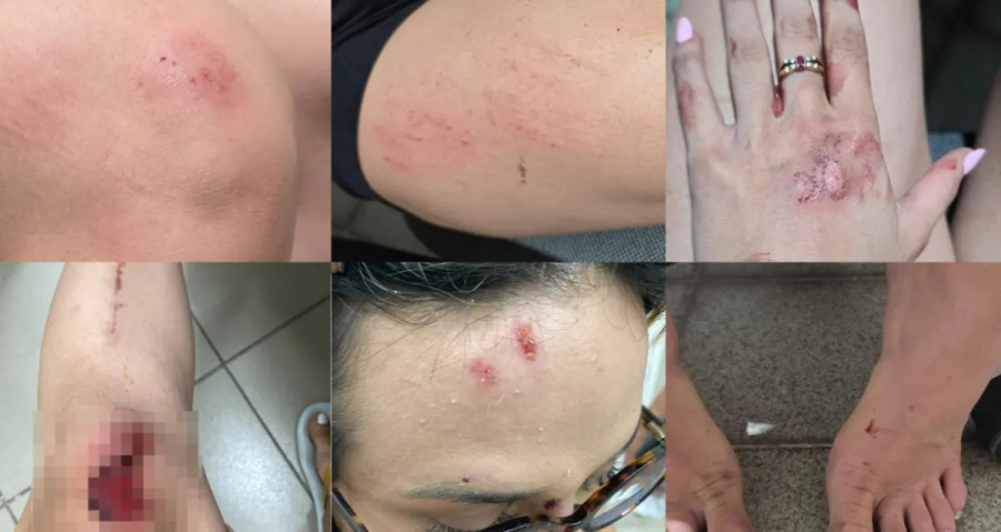 Influenciadora Bárbara Souza denuncia ex-companheiro por agressão, roubo e descumprimento de medida protetiva em Maceió