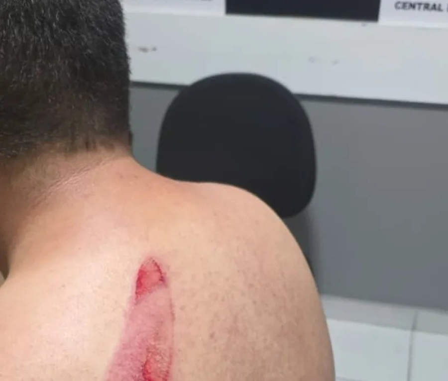 Jovem de 27 anos é esfaqueado pelas costas durante confusão política no Conjunto Medeiros Neto, em Maceió